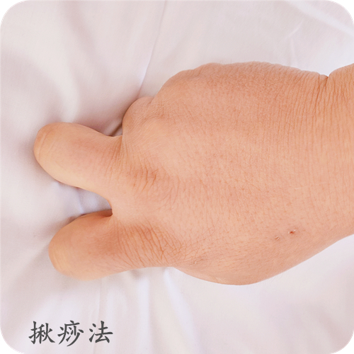 揪痧法